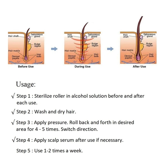 Cosprof 2.5mm Derma Roller, Titanium Micro Needling Roller, Face Care Massage - Picture 6 of 7